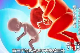女子怀了双胞胎，两胎儿相差悬殊，大胎儿竟不断吸取小胎儿的血视频封面