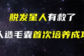 脱发星人有救了，人造毛囊首次培养成功！视频封面