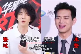 男星整容未整容对比，胡歌俞灏明情非得已，还有一位蛇精脸太恐怖视频封面