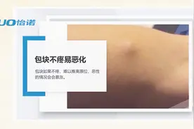 身上有长了包块 尤其是不疼的 要小心 容易恶化视频封面