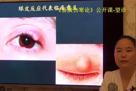 中医望诊眼皮红肿麦粒肿霰粒肿形成机理-易演伤寒论公开课视频封面