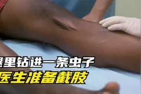 男人腿里钻进一条虫子，医生当机立断准备截肢！视频封面