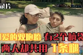 外国一对双胞胎身体相连，共用一个生殖器官，谁看到都吓一跳！视频封面