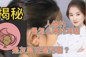 医学揭秘 人体的耳垢耳屎是如何产生的？是灰尘？还是自身酝酿视频封面