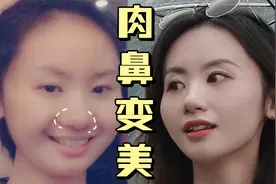 鼻子变小巧精致！放松锻炼鼻周是关键～视频封面