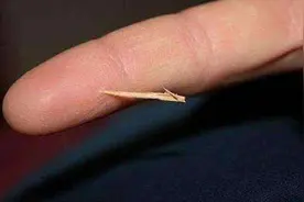 手指扎了根刺不用怕？教你两个方法不用针挑，刺自己跑出来，实用视频封面