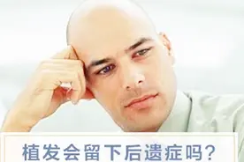 植发后会有哪些后遗症？视频封面