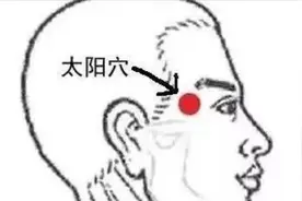 头痛偏头痛的艾灸调理方法及配穴视频封面