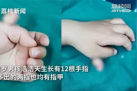 男孩长出12根手指！妈妈：经常自卑，不敢和小朋友玩视频封面