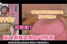 你见过双胞胎出生既然相隔一个月吗？这还能叫双胞胎?世界奇闻呀视频封面