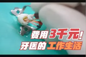 牙齿疼痛就必须做根管治疗吗，费用达几千元合理否，了解一下吧视频封面