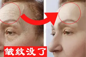 怎样减少皱纹？皱纹增多是胃经气血亏虚，每天3分钟皱纹悄悄消失视频封面