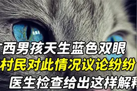 广西男孩天生蓝色双眼，有夜视能力还会发光，难道真是猫妖转世？视频封面