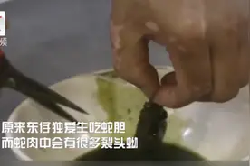 生吞蛇胆 男子脑内长30cm活虫 医生：整个手术室都震惊了视频封面