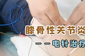 巩固治疗：一根电针，轻松解决骨性关节炎引起的膝盖疼痛视频封面