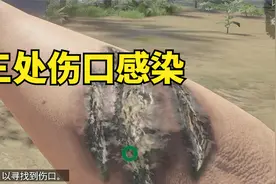 在野外三处伤口感染怎么办？用蛆虫就可以解决！视频封面