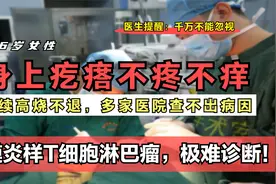 身上长的疙瘩不疼不痒，是不是不需要管？医生坦言：千万不能忽视视频封面