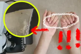 1克指甲盖垢中，有40亿个细菌，来看显微镜下的指甲盖是啥样视频封面
