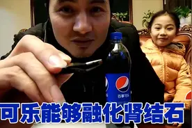 肾结石很疼吧！胃病老陈帮你做个实验，看看可乐能不能把它化了视频封面