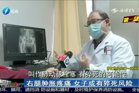 女子右腿异常肿胀，都快走不动路了，这个不良习惯或许是祸根视频封面