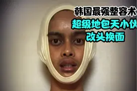 韩国最强整容术，超级地包天小伙改头换面变帅哥视频封面
