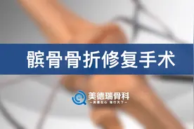 「医学视频科普」髌骨骨折修复手术全过程视频封面