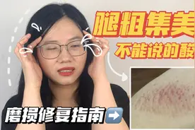 腿粗姐妹进！抗炎+修护解决夏季大腿内侧磨损尴尬！视频封面