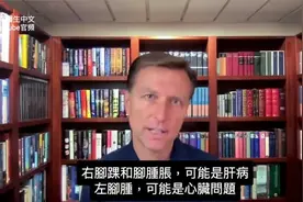 腳水腫的原因,不要掩蓋症狀!!柏格醫生 Dr Berg视频封面