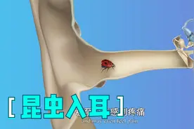 昆虫钻入耳朵怎么办？第一时间采取正确急救措施，真的很重要！视频封面