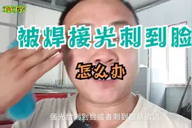 焊接过程中被强光刺到脸和眼睛该怎么办@，这里有经验分享视频封面