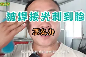 焊接过程中被强光刺到脸和眼睛该怎么办@，这里有经验分享视频封面