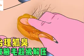 狐臭的原因找到了，原来是腋毛太过浓密，拔毛过程超级解压！视频封面