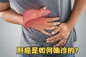 肝癌是如何确诊的？这3种常见的方法，能及早发现病情视频封面