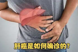 肝癌是如何确诊的？这3种常见的方法，能及早发现病情视频封面
