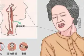穿上高领衫就撅过去？冬天小心“衣领综合征”御寒利器非人人适用视频封面