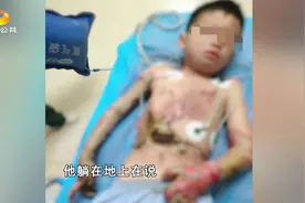 7岁男童意外电击伤右臂截肢 父亲：我卖血都要救他视频封面