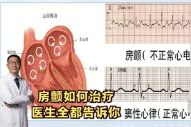 房颤，最容易导致脑梗塞！医生：3种治疗方法，房颤患者都要知道视频封面