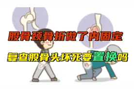 股骨颈骨折做了内固定，近期复查提示股骨头坏死，必须要置换吗？视频封面