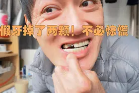 种植牙掉了两颗怎么办？聊一聊种植牙是怎么一回事视频封面