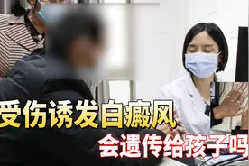 白癜风大叔来就诊，皮肤瘙痒指甲感染，多种皮肤病齐发视频封面