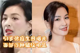51岁张庭生图曝光，面部浮肿皱纹明显，直播一晚狂赚1.28亿！视频封面