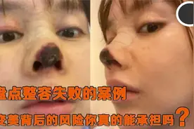 盘点整容失败的案例，郑州张女士做大腿抽脂，手术失败成狗腿！视频封面