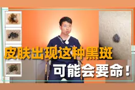 皮肤出现这两种黑斑，可能要人命视频封面
