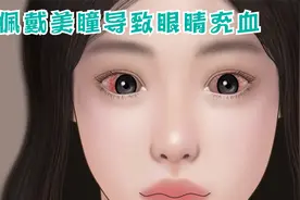 女孩常年佩戴美瞳，导致眼睛充血，有失明的危险视频封面