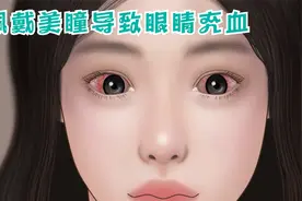 女孩常年佩戴美瞳，导致眼睛充血，有失明的危险视频封面