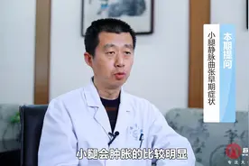 小腿静脉曲张早期症状有哪些？视频封面