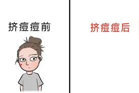 用一幅画展示“挤痘痘前后”的变化，形象到笑喷了！哈哈哈视频封面