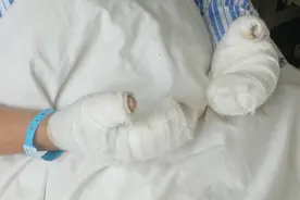 八旬老人上山祭祀引燃枯草殃及自己和儿子 70%烧伤 未脱离危险视频封面