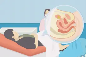 功能性子宫出血怎么办？能不能自愈呢？视频封面