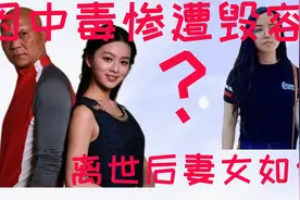 因中毒遭到毁容，无眉无发演尽反派，计春华离世后妻女现在如何视频封面